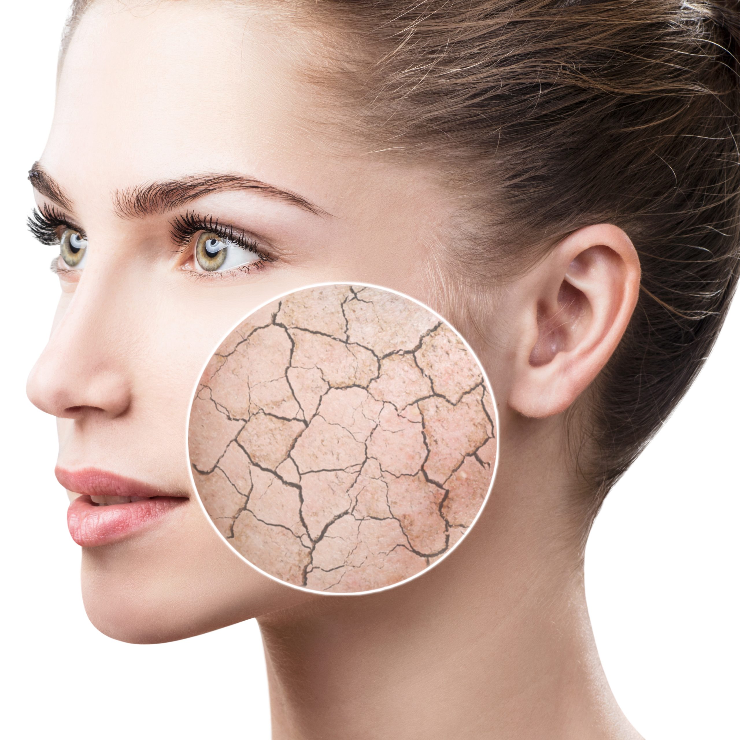 Zoom,Circle,Shows,Dry,Facial,Skin,Before,Moistening.,Skin,Care